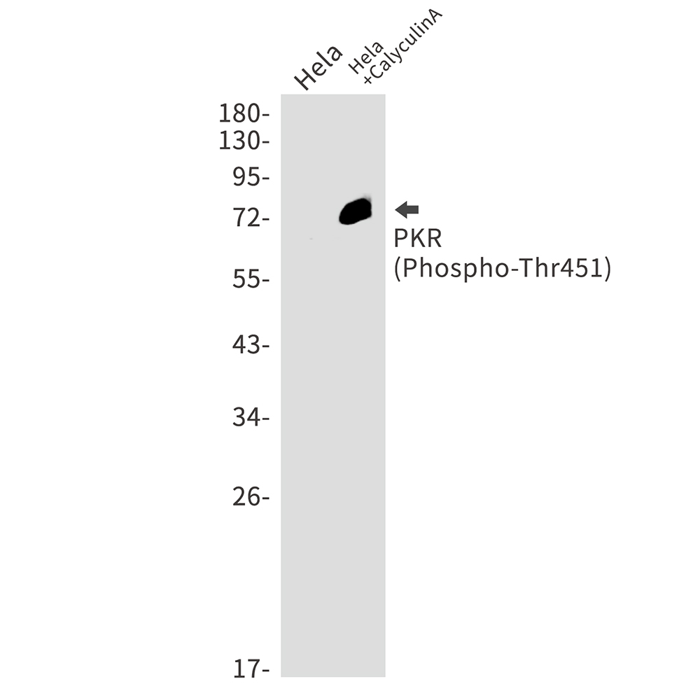 [KO]Phospho-PKR (Thr451) Rabbit mAb ABZ4724