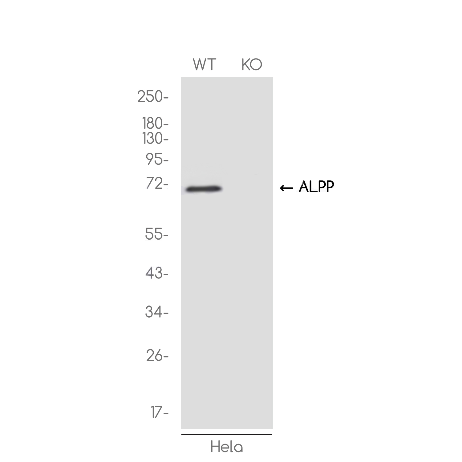 [KO]Placental Alkaline Phosphatase Rabbit mAb ABZ4725