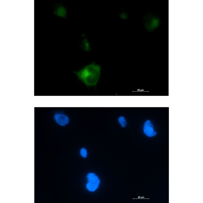 [KD]Rab5 Rabbit mAb ABZ4726