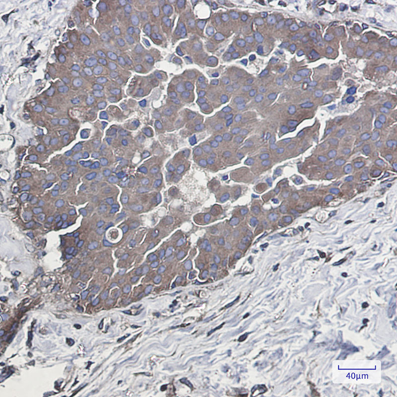 [KD]Rab5 Rabbit mAb ABZ4726
