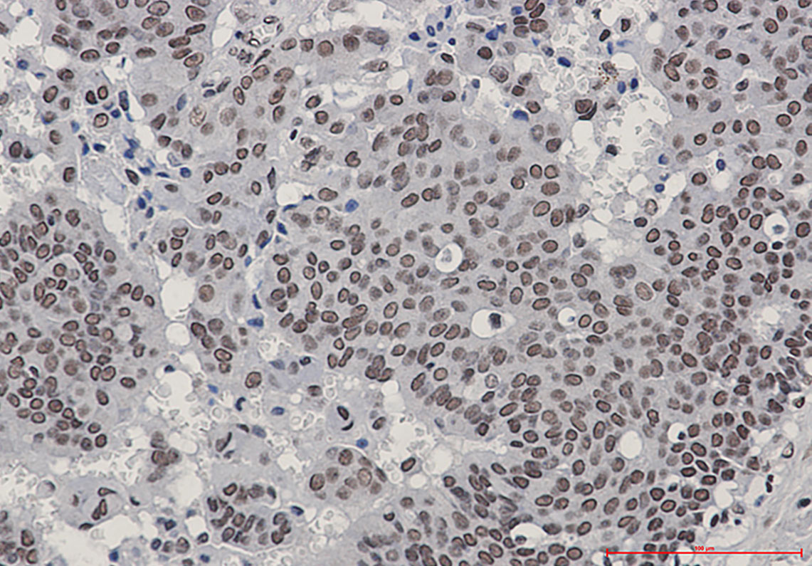 [KO]Phospho-HSF1 (Ser303/Ser307) Rabbit mAb ABZ4731