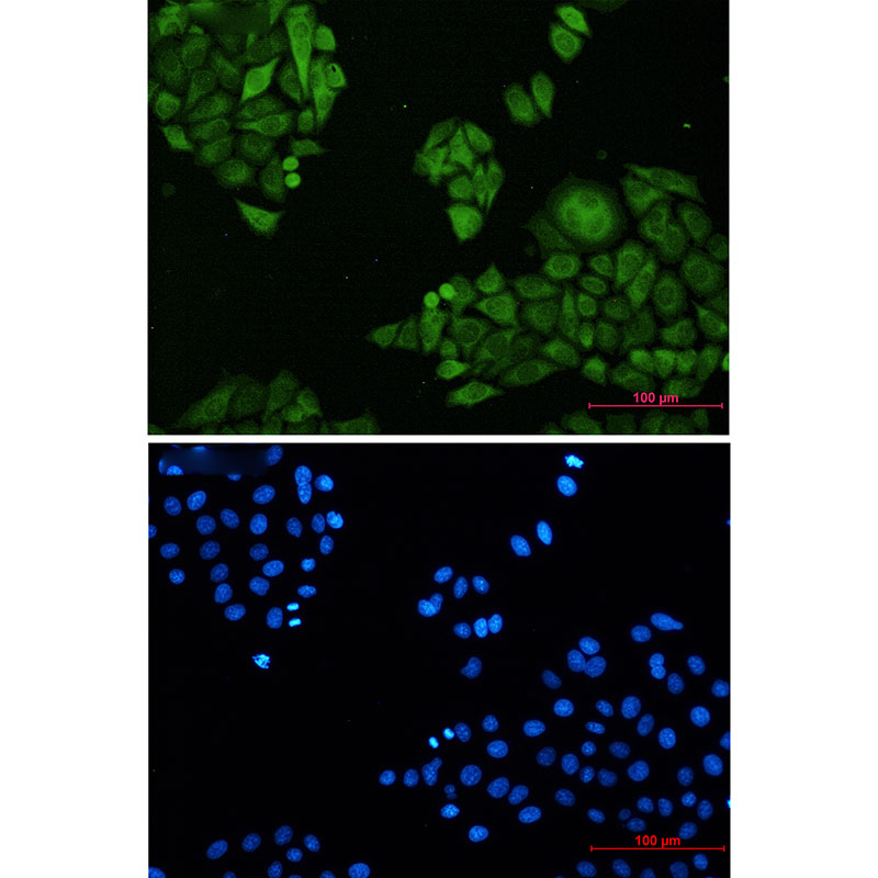 [KO]Annexin 4 Rabbit mAb ABZ4732