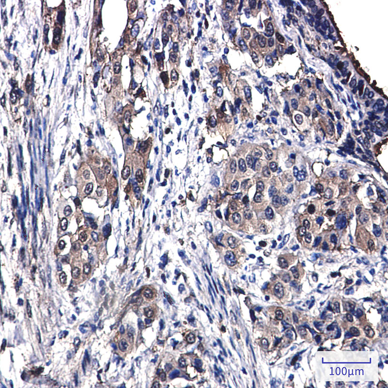 [KO]Annexin 4 Rabbit mAb ABZ4732