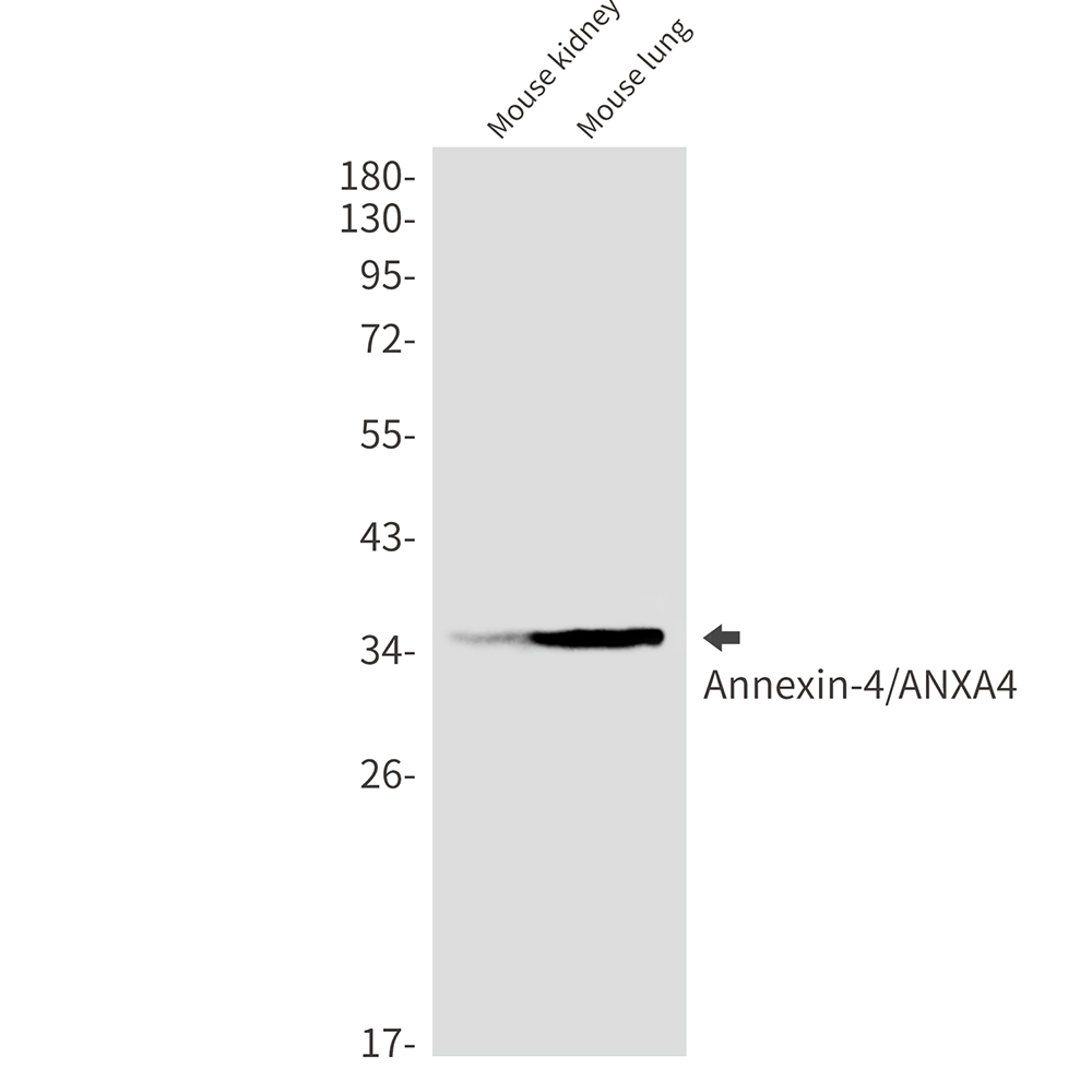 [KO]Annexin 4 Rabbit mAb ABZ4732