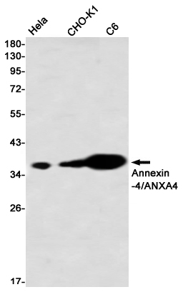 [KO]Annexin 4 Rabbit mAb ABZ4732