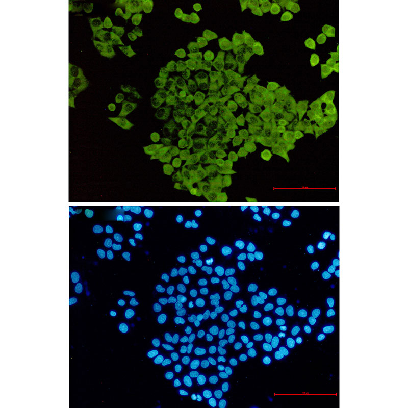 [KO]Cofilin 1 Rabbit mAb ABZ4736