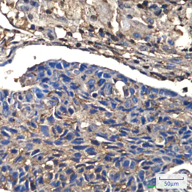 [KO]Cofilin 1 Rabbit mAb ABZ4736