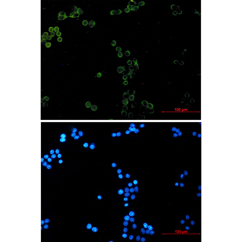 [KO]Glutathione Peroxidase 1 Rabbit mAb ABZ4737