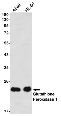 [KO]Glutathione Peroxidase 1 Rabbit mAb ABZ4737