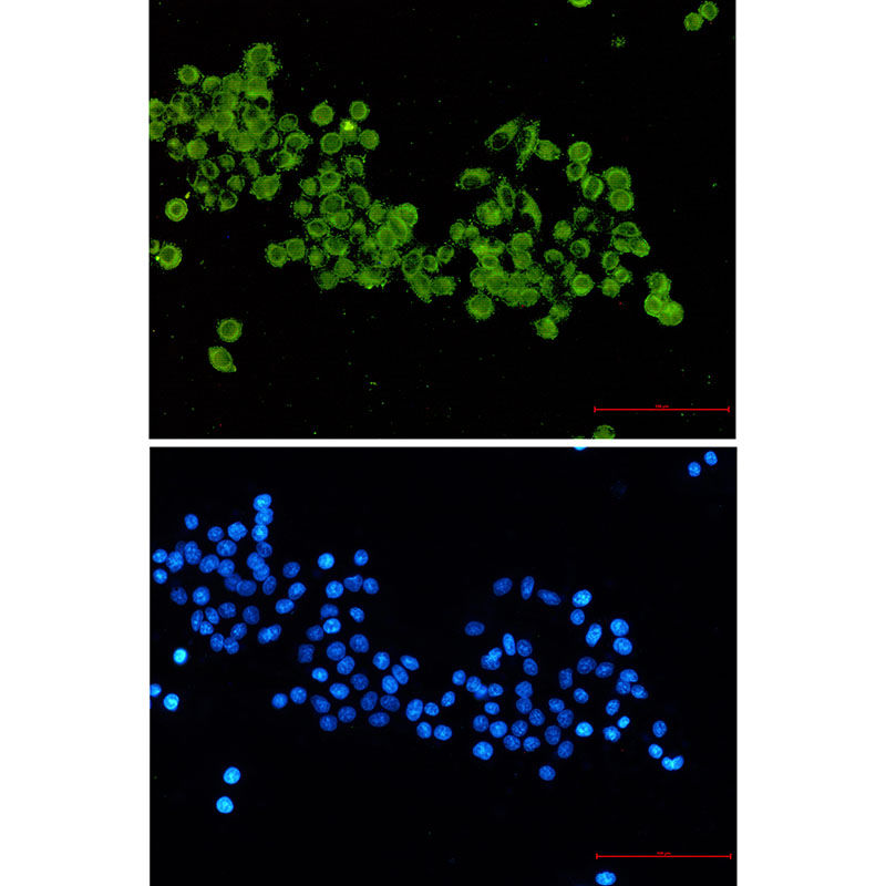 [KD]Pyruvate Dehydrogenase E2 Rabbit mAb ABZ4739