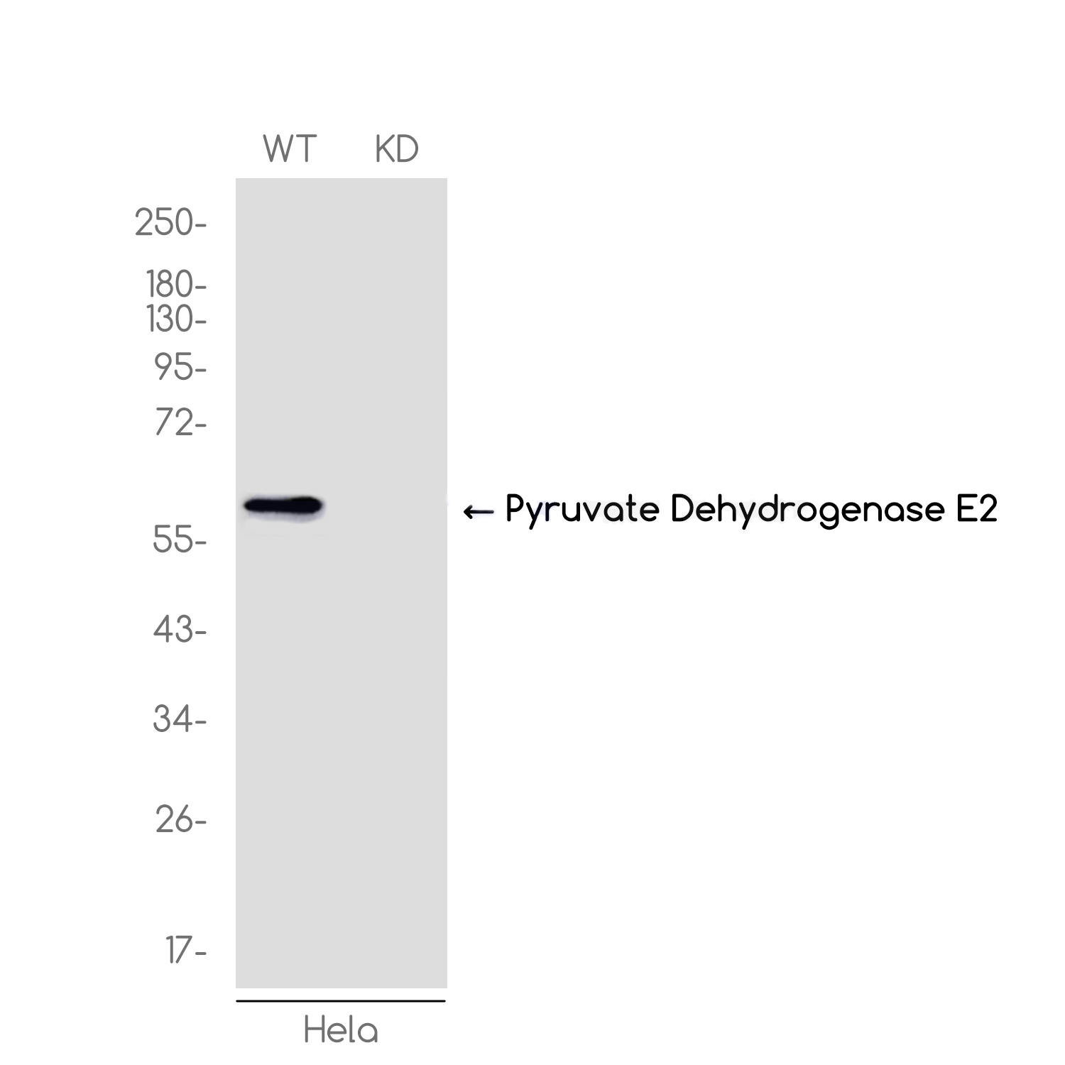 [KD]Pyruvate Dehydrogenase E2 Rabbit mAb ABZ4739