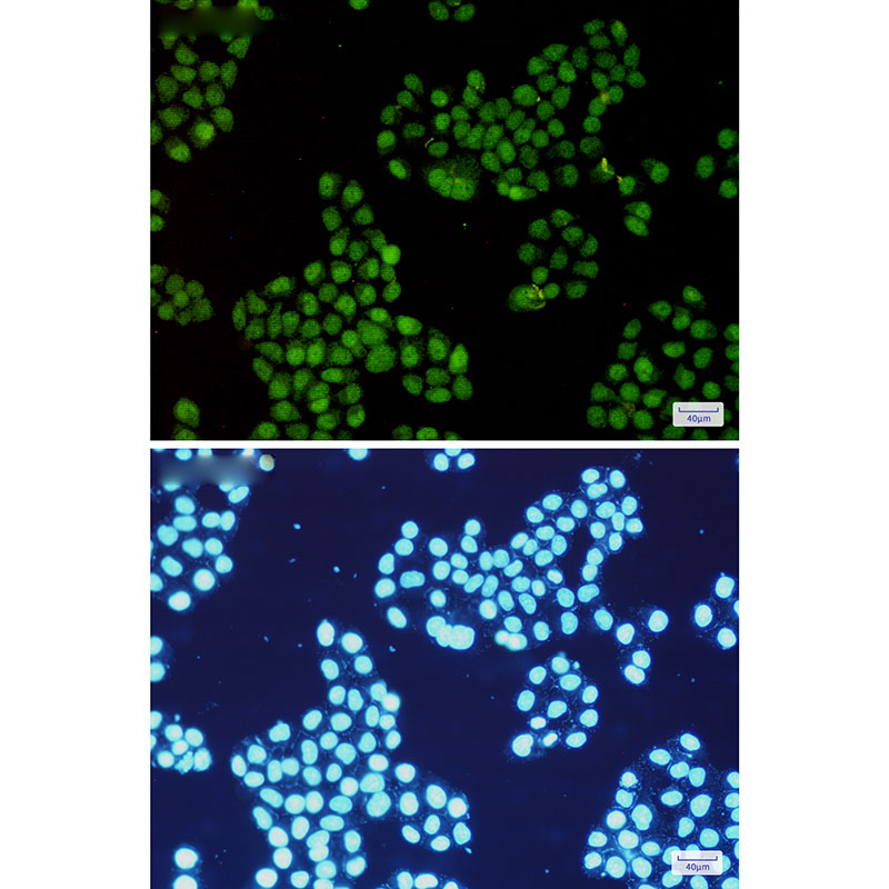 [KO]CDK2 Rabbit mAb ABZ4740
