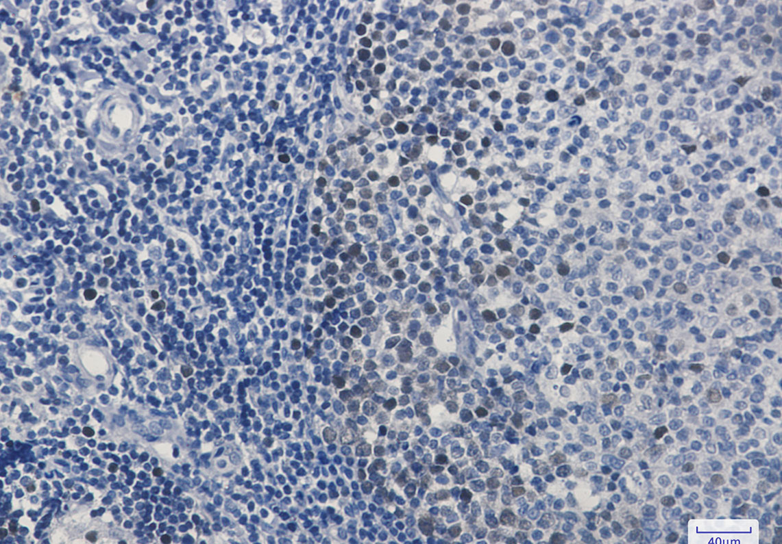 [KO]CDK2 Rabbit mAb ABZ4740