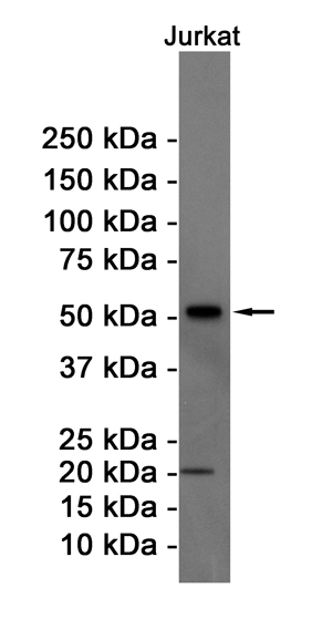 [KD]Cyclin B1 Rabbit mAb ABZ4741