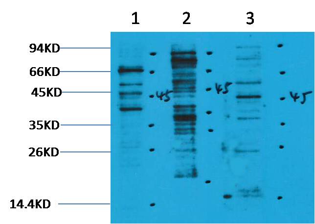 Methyl-Lysine Rabbit pAb ABZ4744