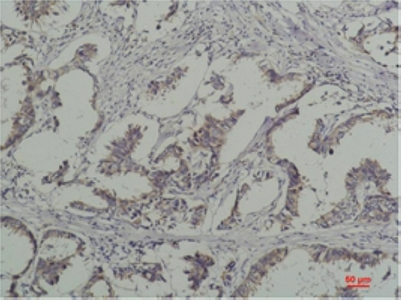 Phospho-Tyrosine (6G6) Mouse mAb ABZ4746