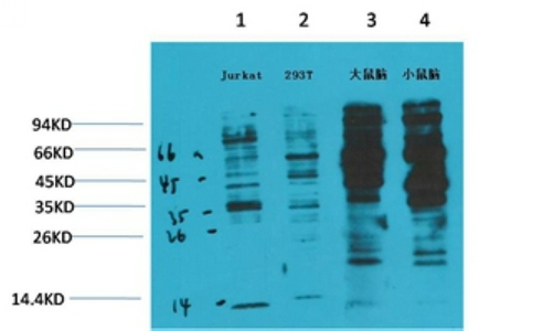 Phospho-Tyrosine (6G6) Mouse mAb ABZ4746