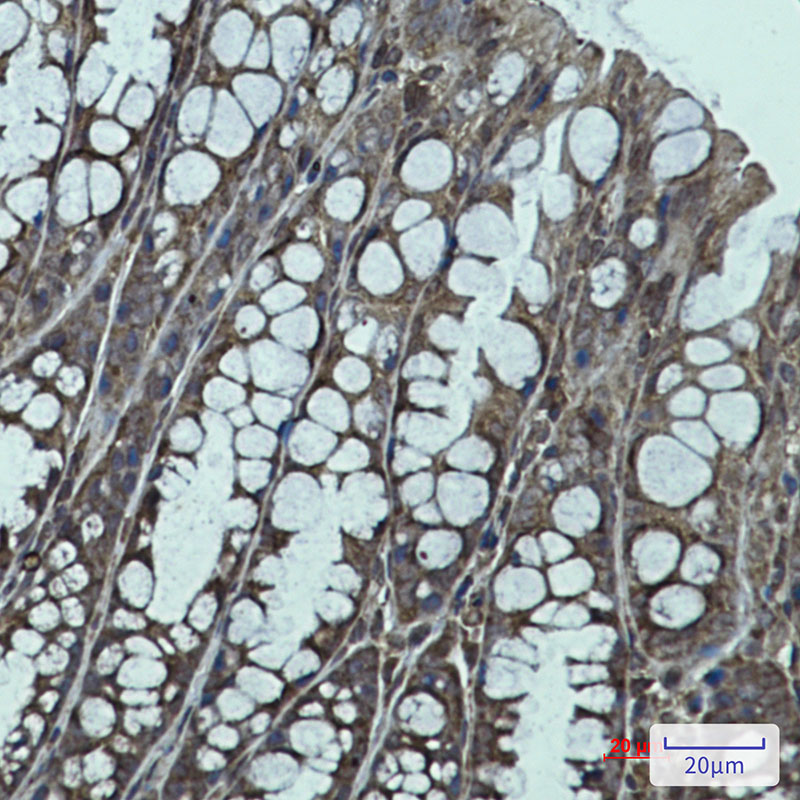 IGF2BP1 Rabbit mAb ABZ4749