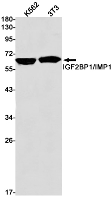 IGF2BP1 Rabbit mAb ABZ4749
