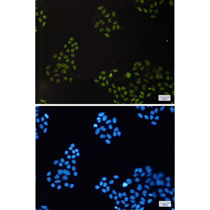 [KD]CGBP Rabbit mAb ABZ4759