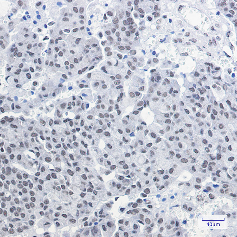 [KD]CGBP Rabbit mAb ABZ4759