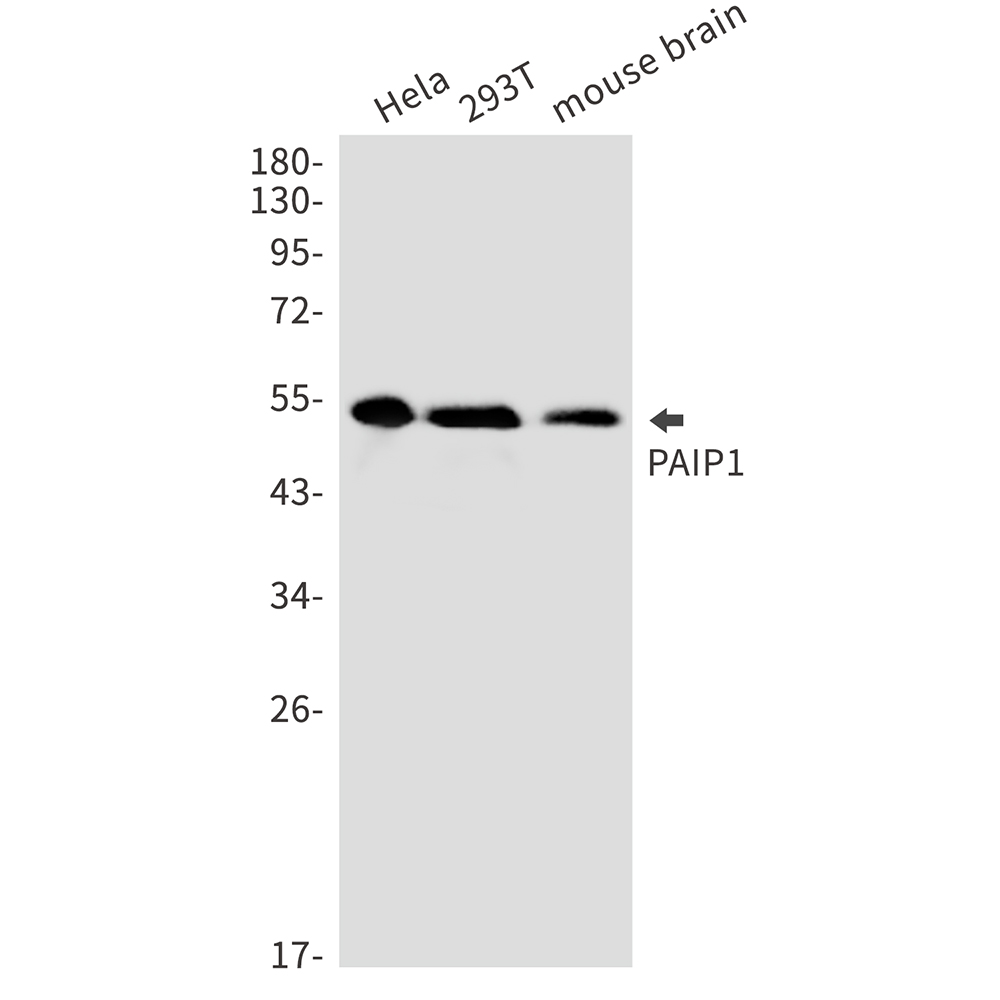 [KD]PAIP1 Rabbit mAb ABZ4761