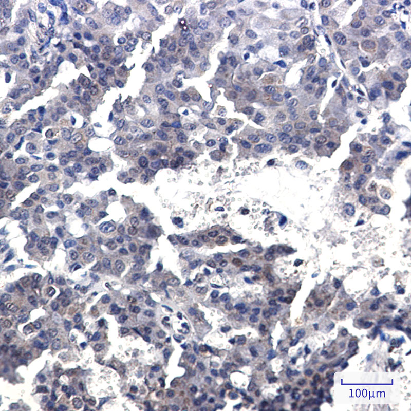 [KD]TORC2 Rabbit mAb ABZ4763