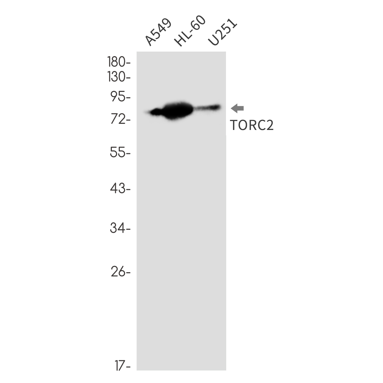 [KD]TORC2 Rabbit mAb ABZ4763
