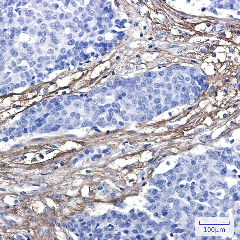 [KO]EFEMP1 Rabbit mAb ABZ4765