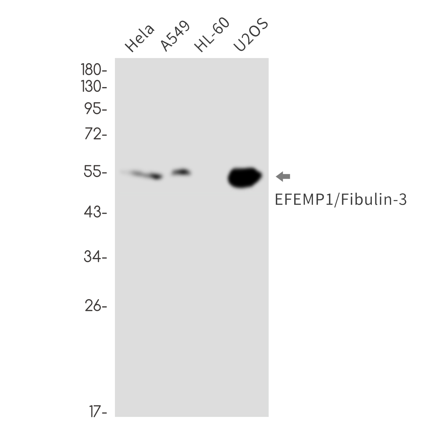 [KO]EFEMP1 Rabbit mAb ABZ4765