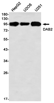 [KO]DAB2 Rabbit mAb ABZ4766
