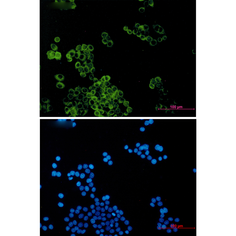 [KD]TCTEX-1 Rabbit mAb ABZ4767