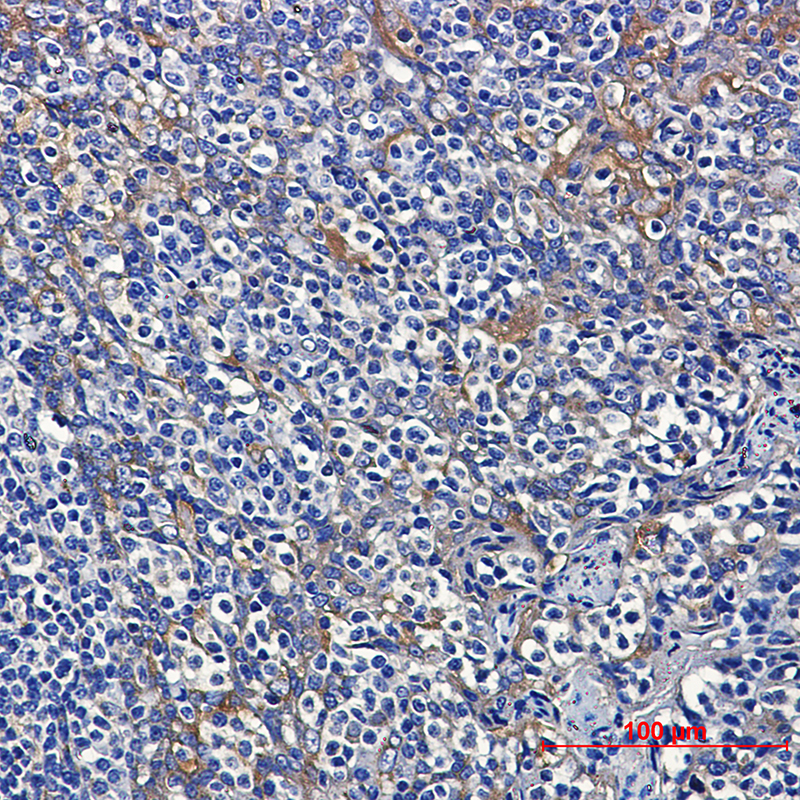 [KD]TCTEX-1 Rabbit mAb ABZ4767