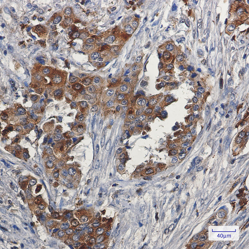 [KD]Niemann Pick C2 Rabbit mAb ABZ4769
