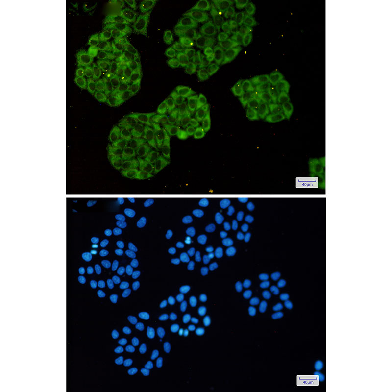 [KO]MetRS Rabbit mAb ABZ4771