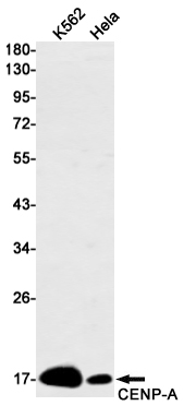[KD]CENPA Rabbit mAb ABZ4774