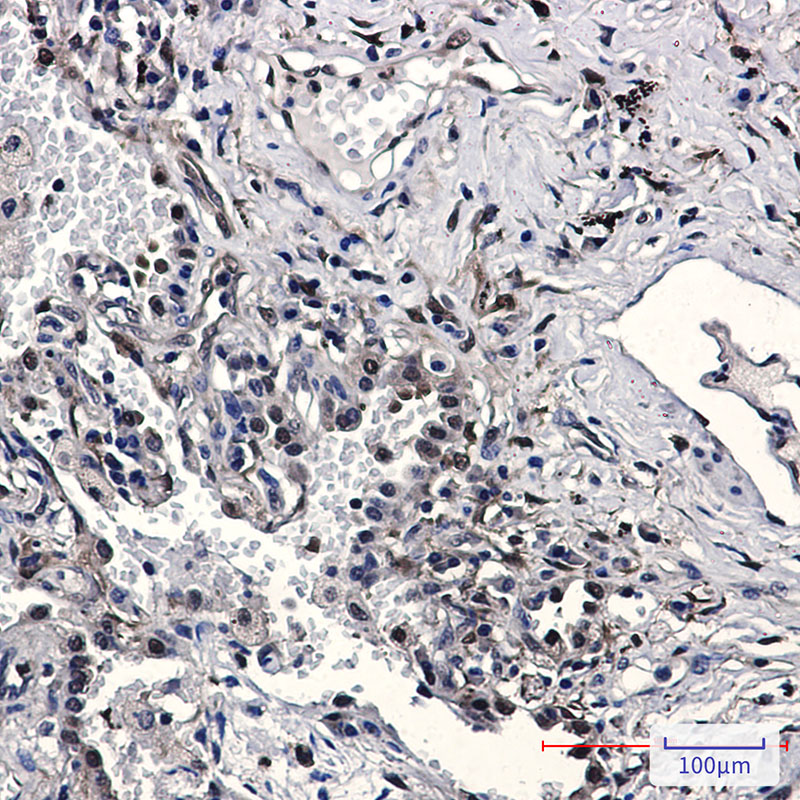 [KD]Nampt Rabbit mAb ABZ4776
