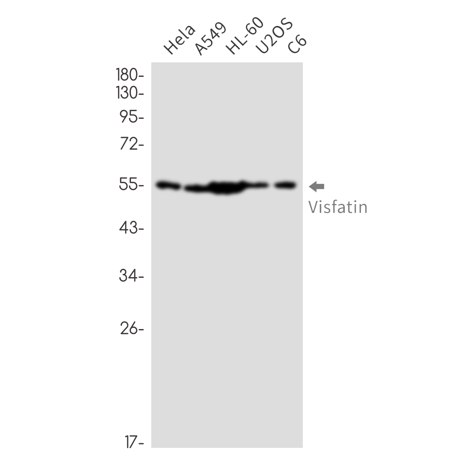 [KD]Nampt Rabbit mAb ABZ4776
