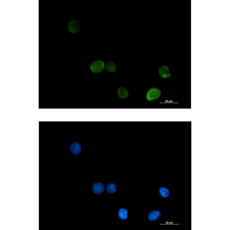[KD]MTHFR Rabbit mAb ABZ4777