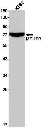 [KD]MTHFR Rabbit mAb ABZ4777