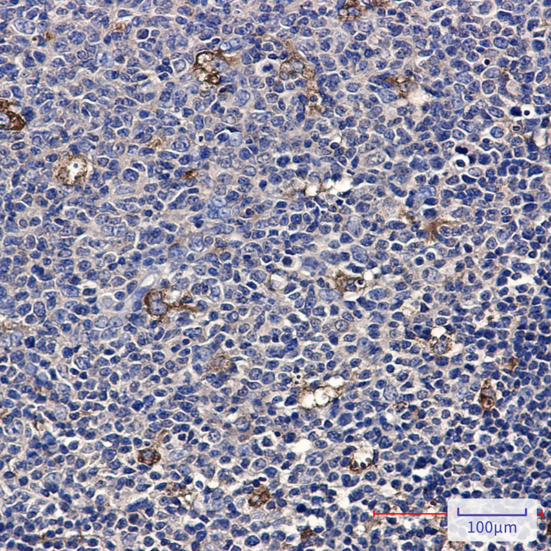 [KD]ATP6V1A Rabbit mAb ABZ4778