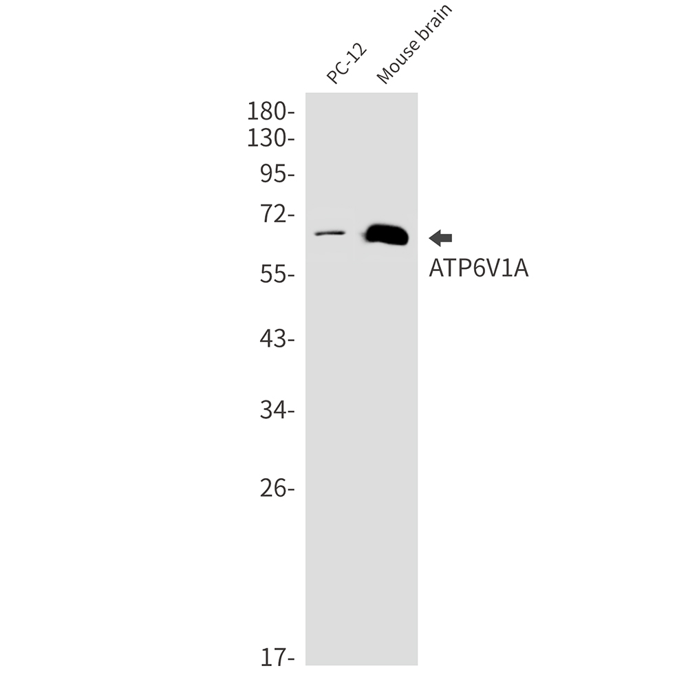 [KD]ATP6V1A Rabbit mAb ABZ4778