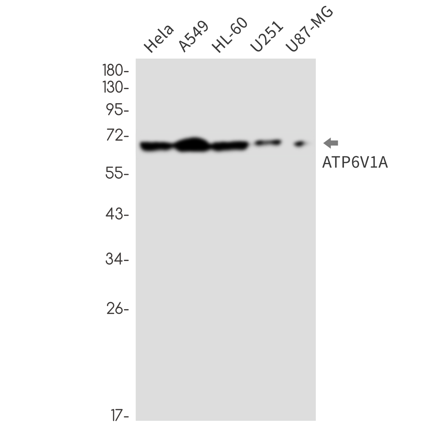[KD]ATP6V1A Rabbit mAb ABZ4778