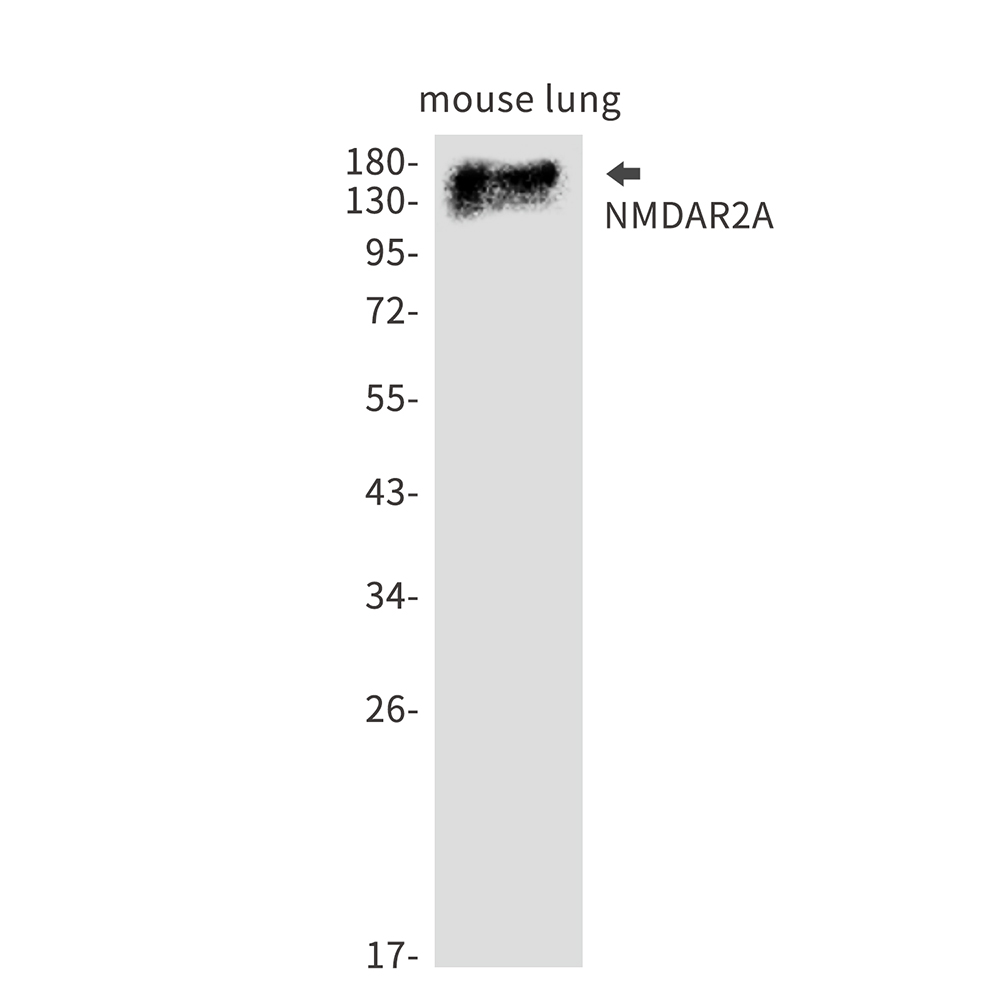 [KD]NMDAR2A Rabbit mAb ABZ4779