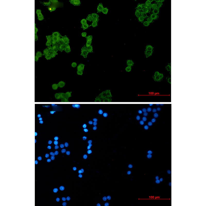 [KD]Ndufs1 Rabbit mAb ABZ4781