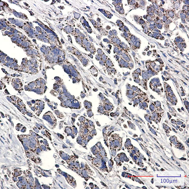 [KD]Ndufs1 Rabbit mAb ABZ4781