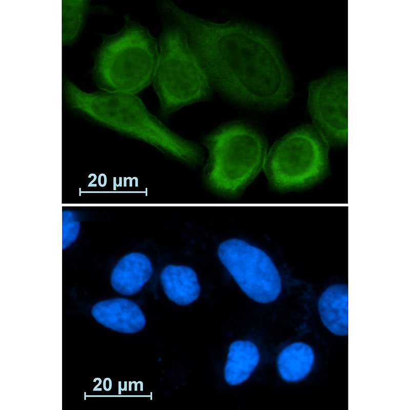 [KD]Annexin A1 Rabbit mAb ABZ4782