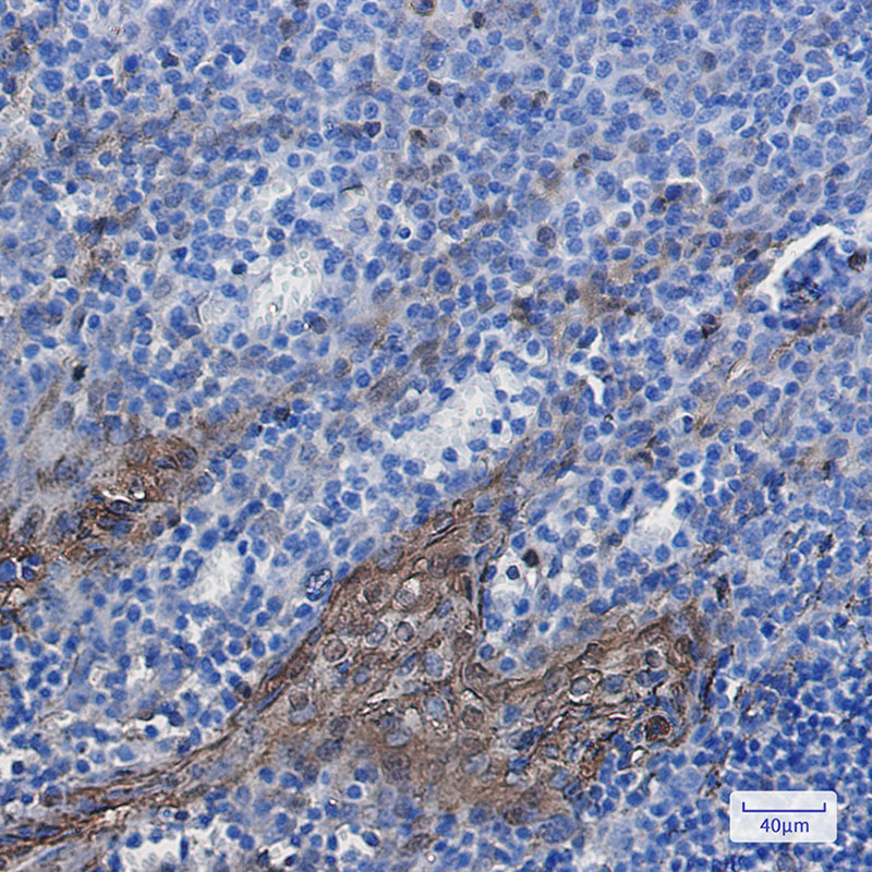 [KD]Annexin A1 Rabbit mAb ABZ4782