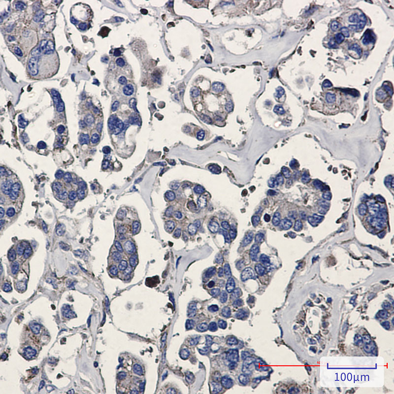 [KO]ARPC5/p16 ARC Rabbit mAb ABZ4783