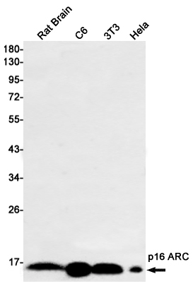 [KO]ARPC5/p16 ARC Rabbit mAb ABZ4783